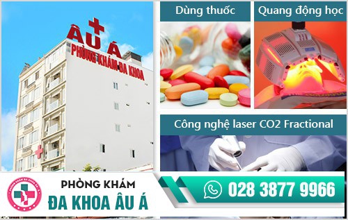 Cách chữa fordyce an toàn, không để lại sẹo